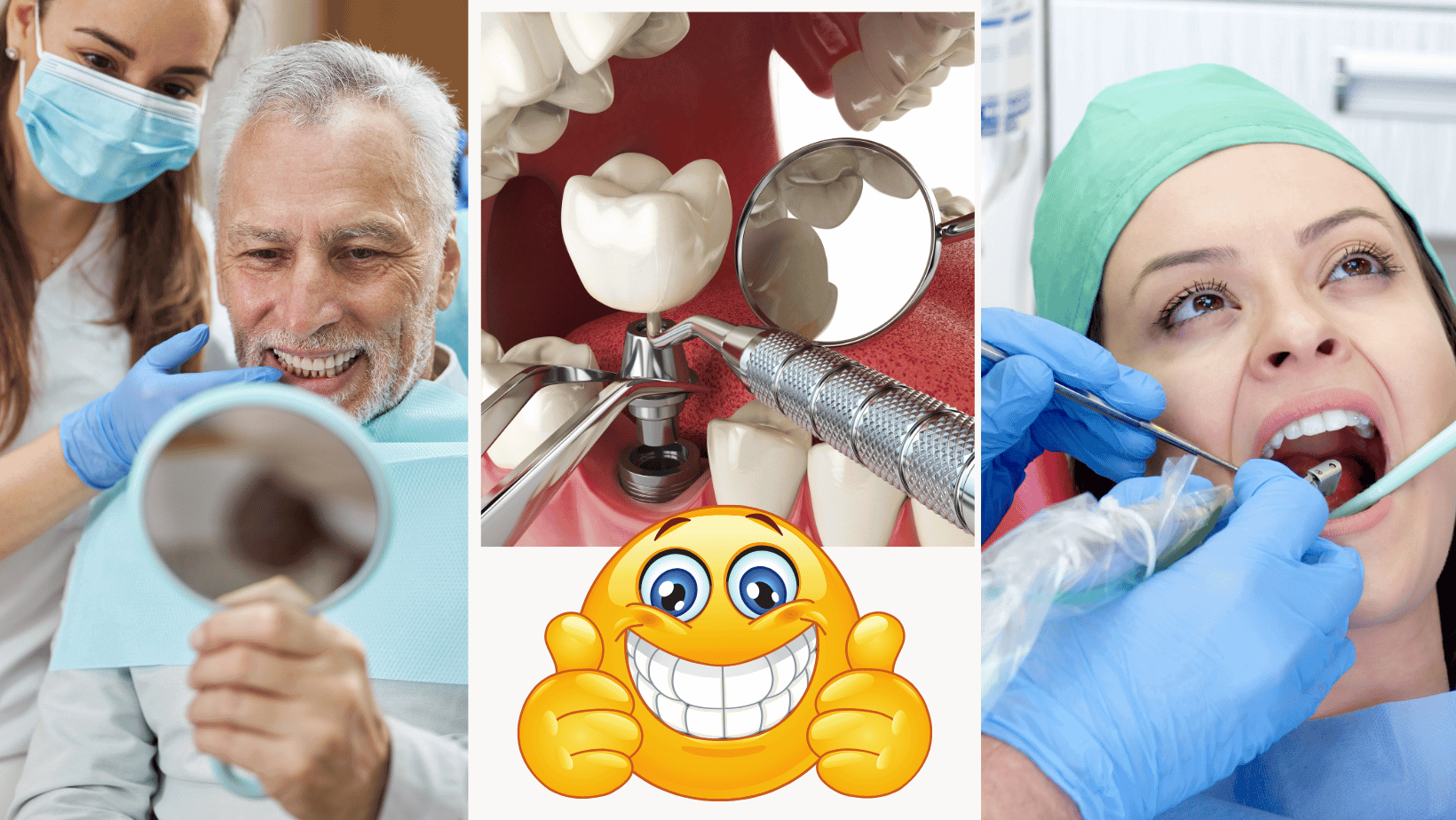 All On 4 Implants: Before, During, And After Care